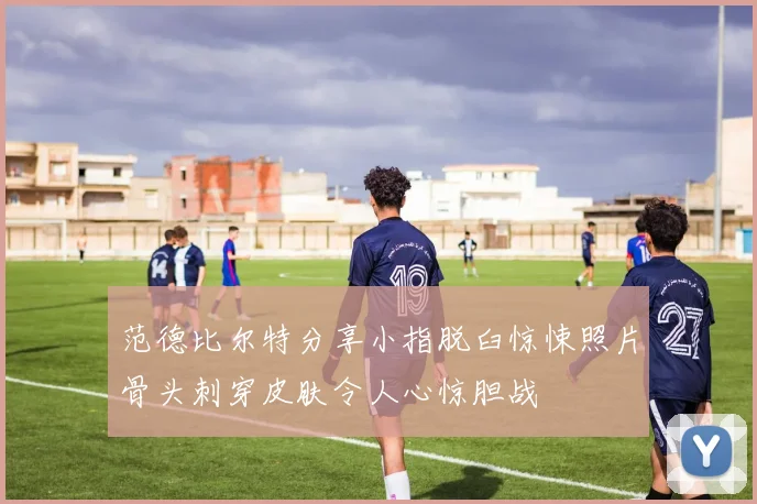 范德比尔特分享小指脱臼惊悚照片骨头刺穿皮肤令人心惊胆战